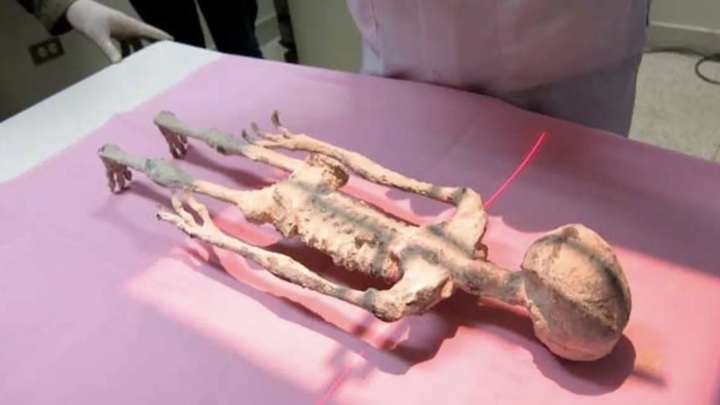 Mummified Alien With Three Fingers MRI Scan Findings